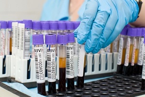 Для реабилитации надо восстановить показатели лабораторных анализов Анализ крови