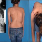 Если болит в грудине посередине и отдает в спину