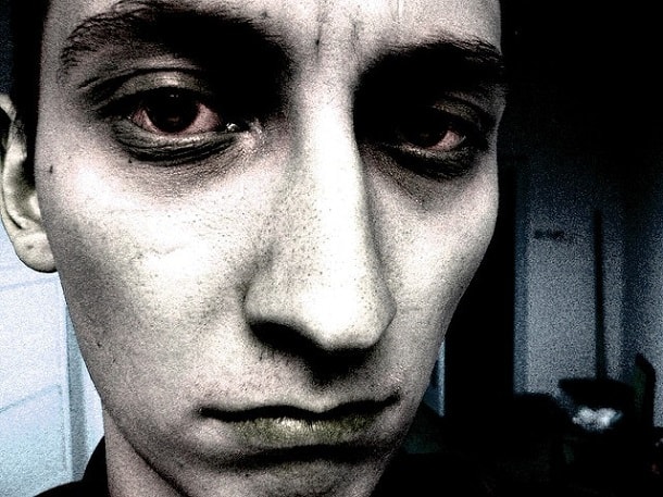 напряжённые мышцы шеи боль в глазах